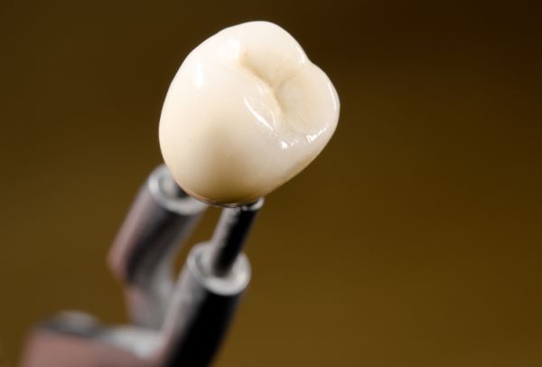 The Application Process Of Dental Crowns