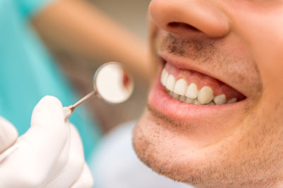 What Materials Are Used To Make Dental Crowns?