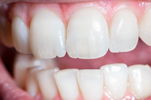 How An Emergency Dentist Can Fix A Cracked Tooth
