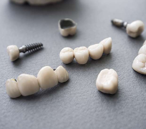 Trophy Club The Difference Between Dental Implants and Mini Dental Implants