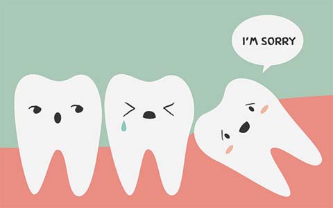 Wisdom Tooth Extractions